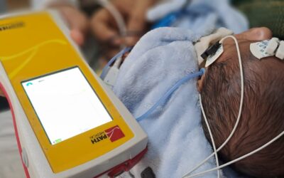 Why Newborn Hearing Screening Is Critical: Detecting Hearing Loss Early